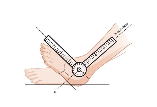 Illustrations médicales